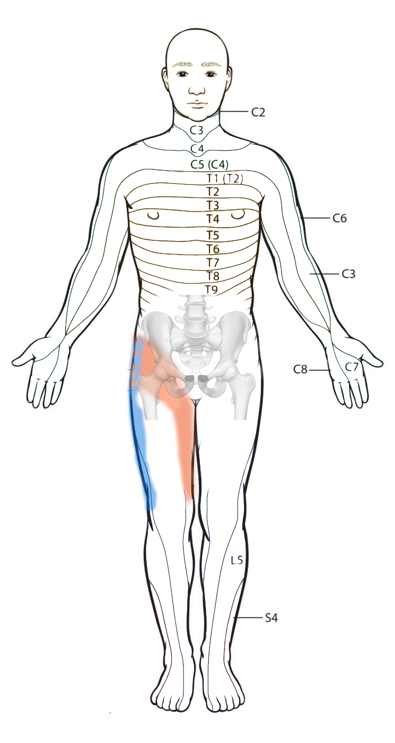 Diagrama Frontal do padrão de dor Coluna e Quadril