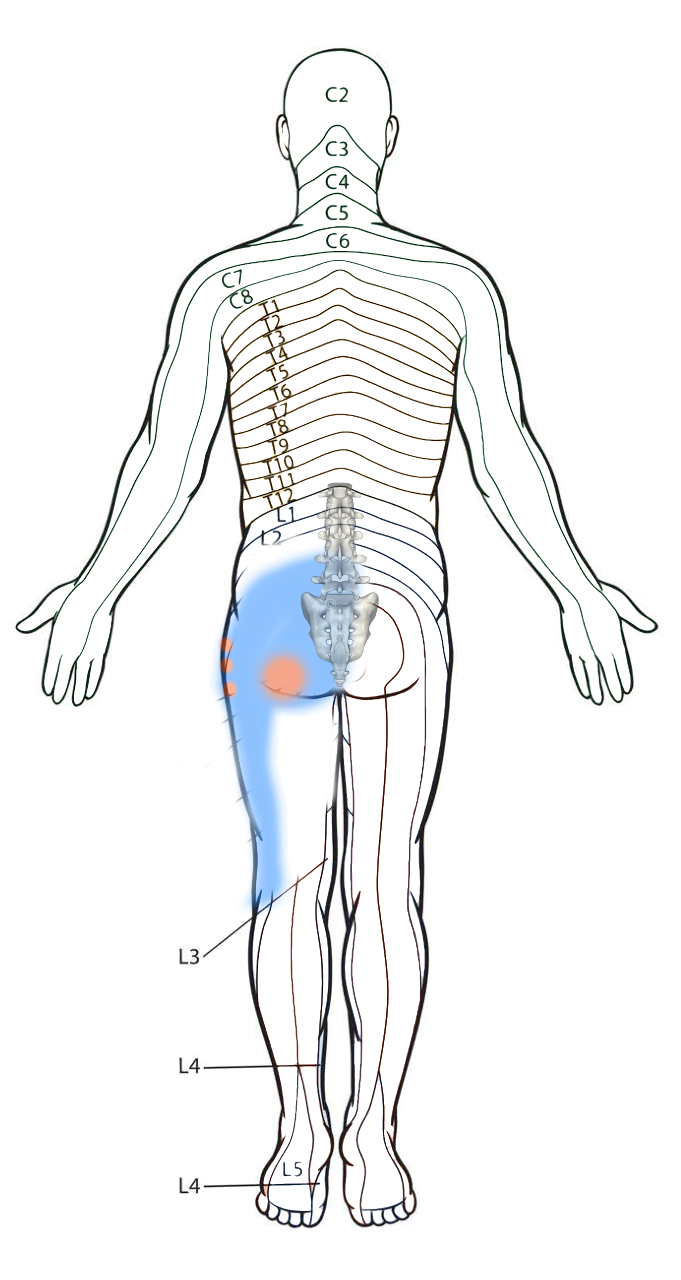 Diagrama Frontal do padrão de dor Coluna e Quadril