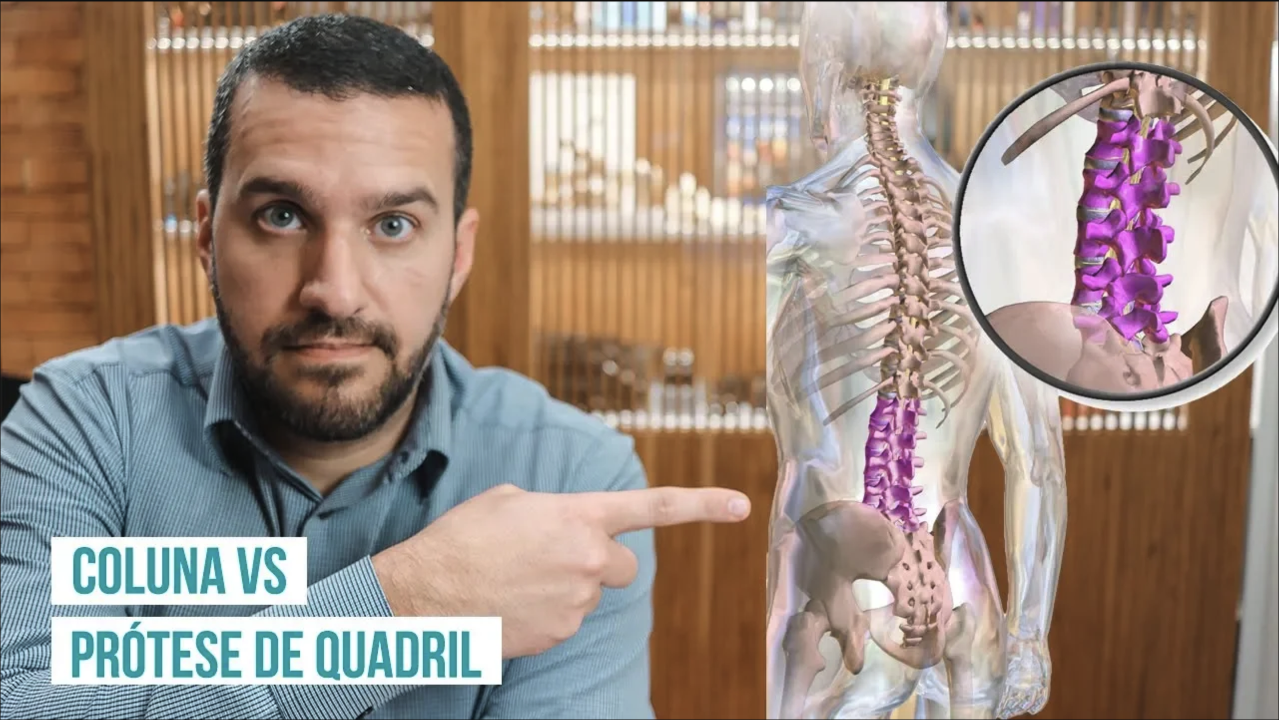 Coluna x Prótese de Quadril: Existe Relação?