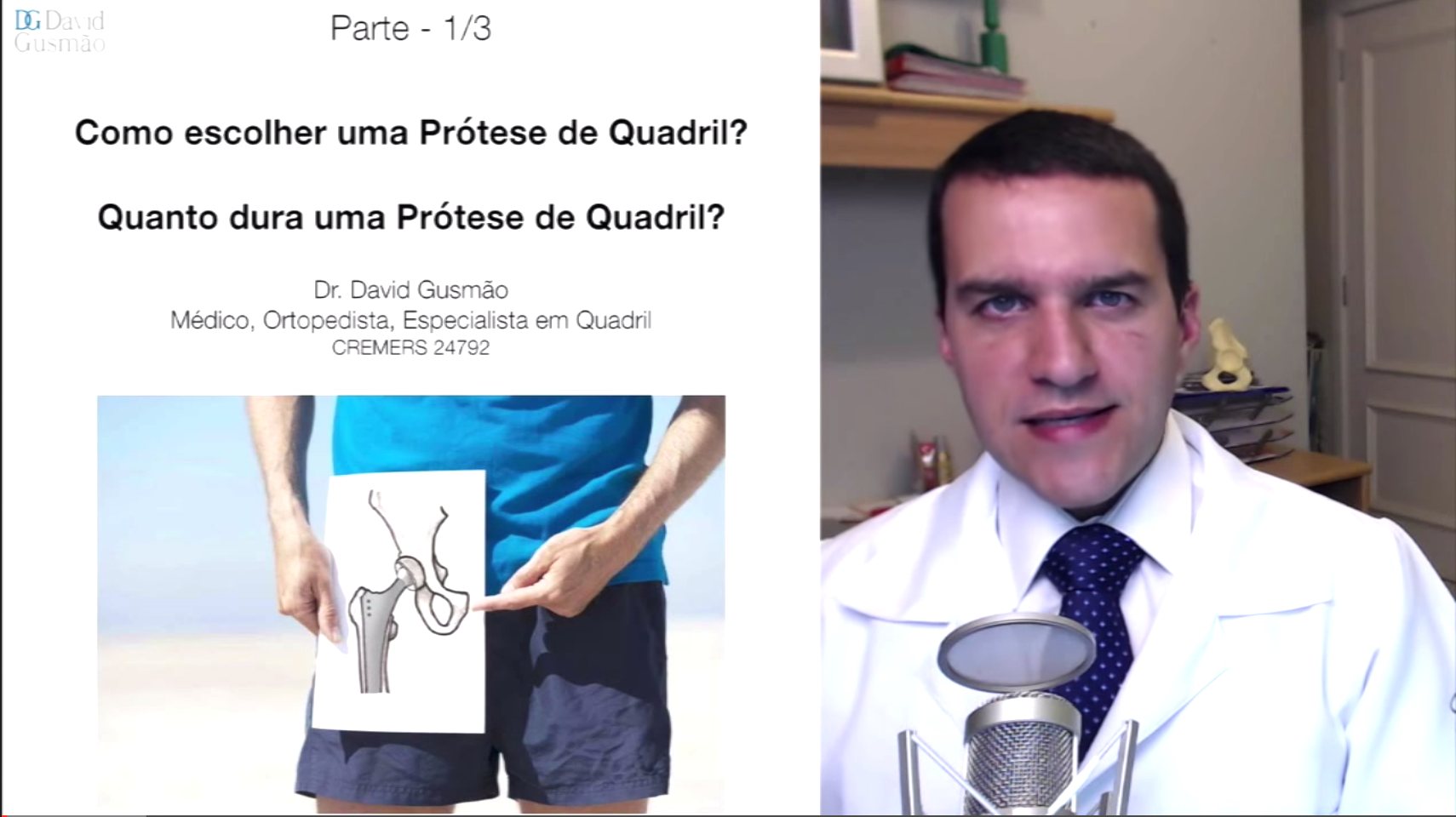 Quanto tempo dura uma Prótese de Quadril? Qual a melhor Prótese de Quadril?