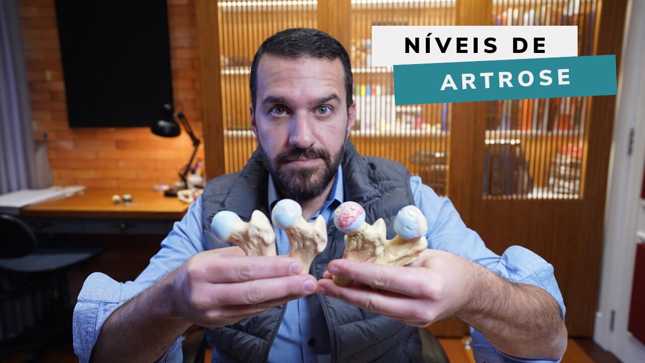 Qual o GRAU da minha Artrose de Quadril? Grau do desgaste da cartilagem?