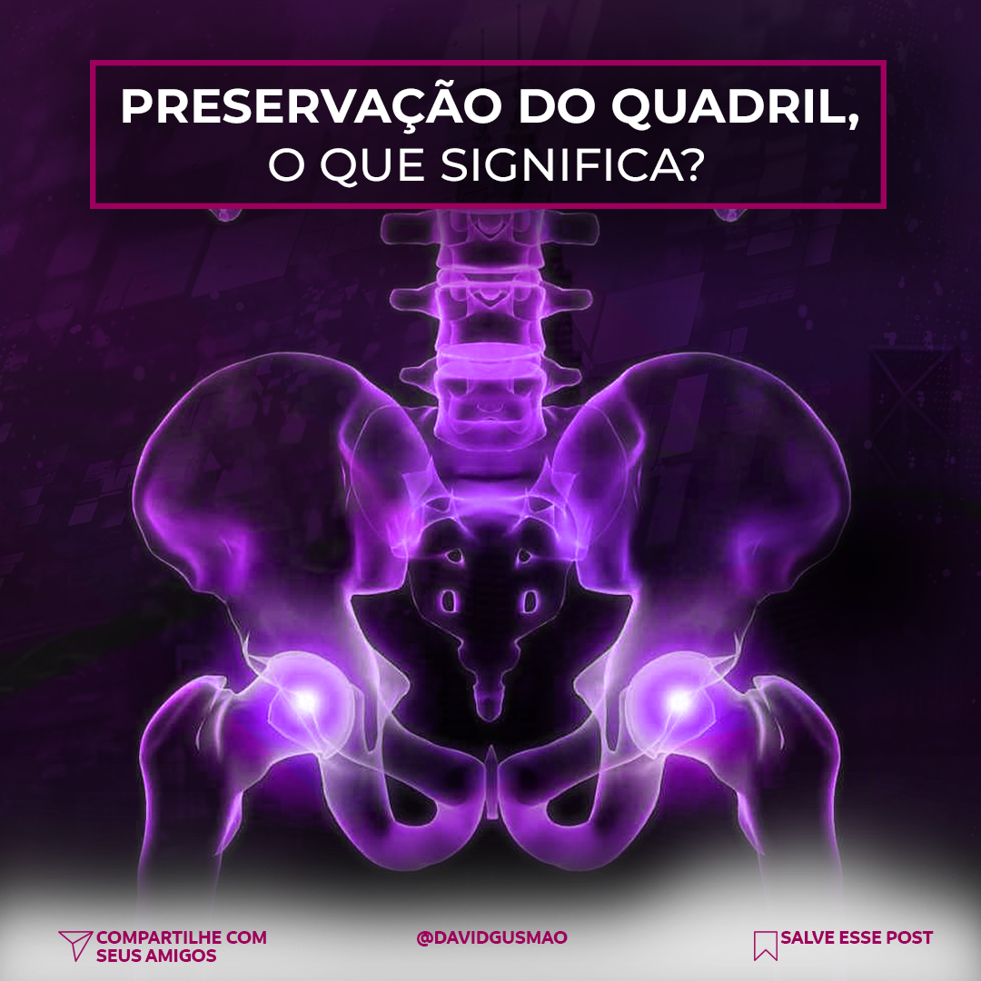 Preservação do Quadril, o que Significa?