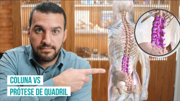 Coluna x Prótese de Quadril: Existe Relação?