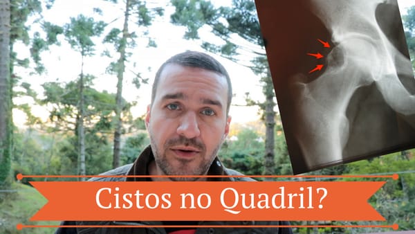 Cistos no Quadril - Dr. David Gusmão Explica sobre os cistos mais comuns no quadril