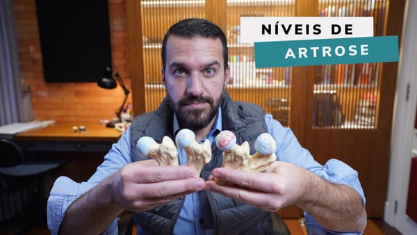 Qual o GRAU da minha Artrose de Quadril? Grau do desgaste da cartilagem?