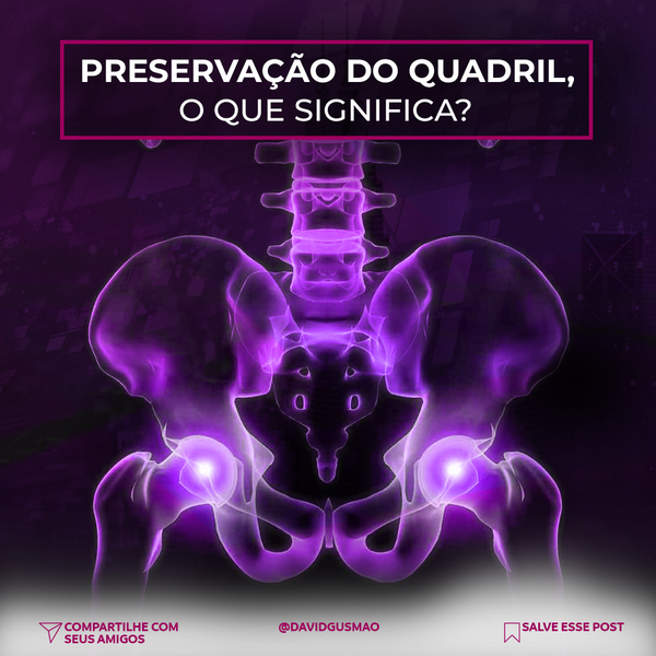 Preservação do Quadril, o que Significa?