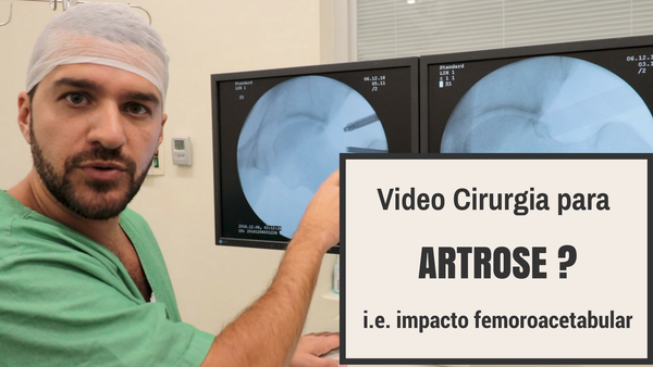 Video cirurgia para Artrose? Tratamento por videoartroscopia de quadril do impacto femoroacetabular
